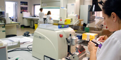 ¿Cuánto gana un Técnico Superior en Anatomía Patológica y Citodiagnóstico? Salario promedio