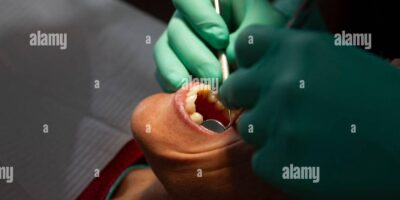 Descubre cuánto cobra un dentista en Francia: ¡Una mirada detallada a los salarios de los profesionales de la odontología!